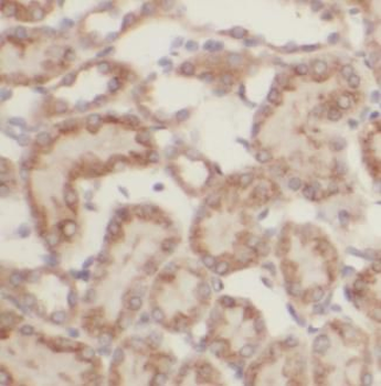 ALDH6A1 Rabbit Polyclonal Antibody