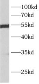 ALDH7A1 Antibody