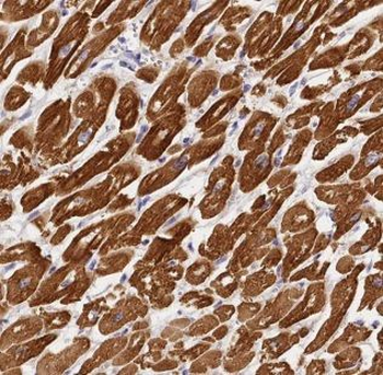 ALDOA Antibody
