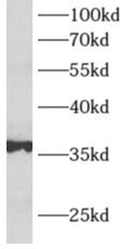 ALDOB Antibody