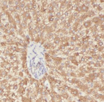 ALDOB Antibody