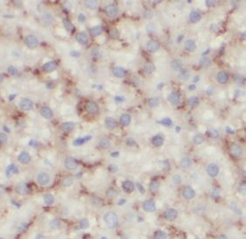 ALDOC Antibody
