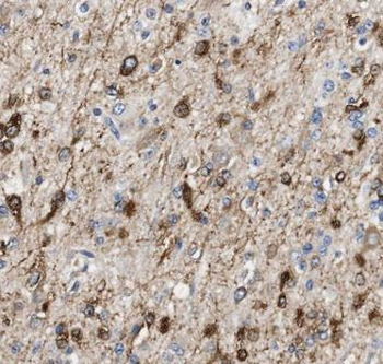 ALG1 Antibody