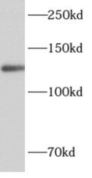 ALG13 Antibody