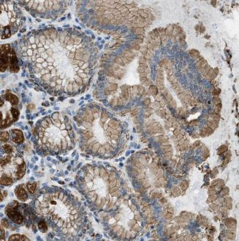 ALG13 Antibody