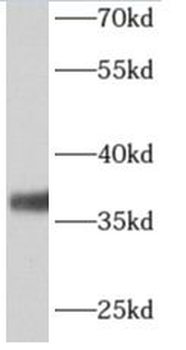 ALG5 Antibody