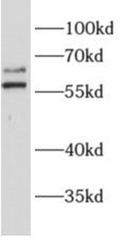 ALG6 Rabbit Polyclonal Antibody