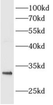 ALKBH3 Antibody