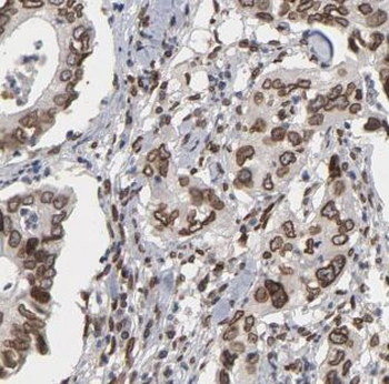 ALKBH3 Antibody