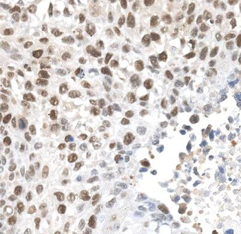 ALKBH5 Antibody