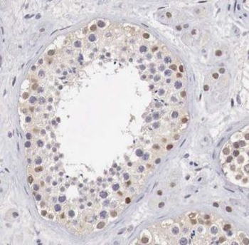ALKBH7 Antibody