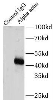 ACTC1 Rabbit Polyclonal Antibody