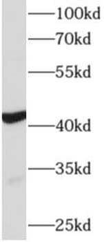 ACTC1 Rabbit Polyclonal Antibody