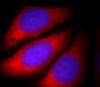 Alpha Actin Rabbit Polyclonal Antibody