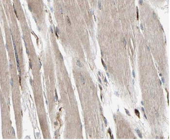Alpha Actin Antibody