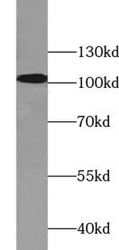 ACTN1 Rabbit Polyclonal Antibody