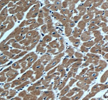 ACTN1 Antibody