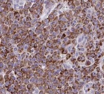alpha Tubulin Rabbit Polyclonal Antibody