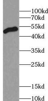 alpha Tubulin Rabbit Polyclonal Antibody