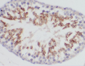 alpha Tubulin Rabbit Polyclonal Antibody