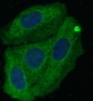 SERPINA1 Mouse Monoclonal Antibody