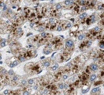SERPINA1 Mouse Monoclonal Antibody