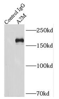 A2M Antibody