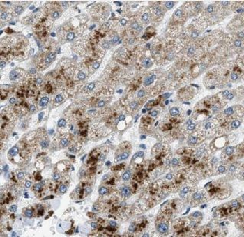ALPK1 Antibody