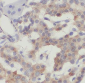 ALS2 Antibody