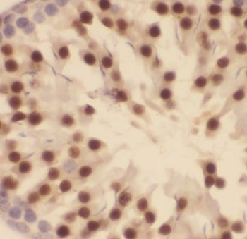 CARF Antibody