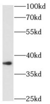ALX1 Antibody