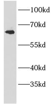 AMH Rabbit Polyclonal Antibody