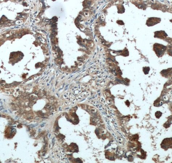 AMH Rabbit Polyclonal Antibody