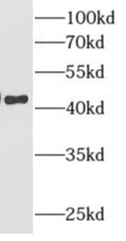 AMMECR1 Antibody