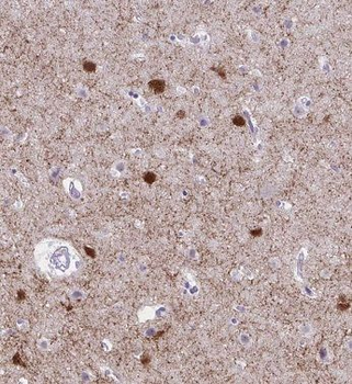 AMMECR1 Antibody