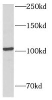 AMPD2 Antibody