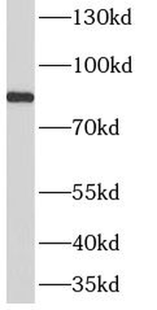 AMPD3 Antibody