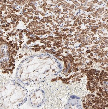 AMPD3 Antibody