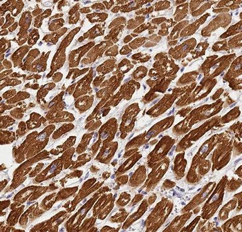PRKAA2 Antibody