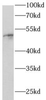 ANGPT1 Rabbit Polyclonal Antibody