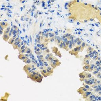 ANGPT1 Antibody