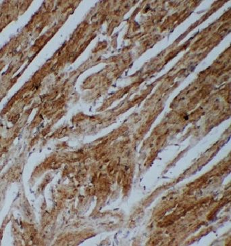 ANGPT2 Antibody
