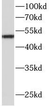 AGT Mouse Monoclonal Antibody