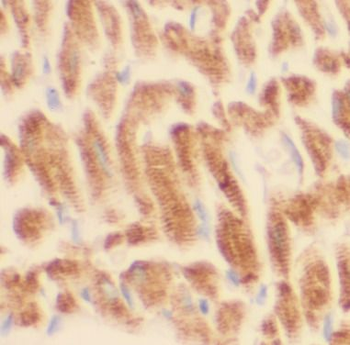 ANGPTL2 Antibody