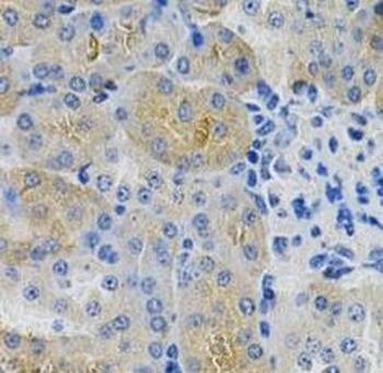 ANGPTL3 Antibody