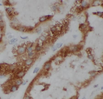 ANGPTL4 Antibody