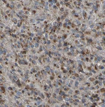 ANGPTL5 Antibody