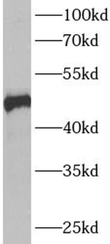 ANKMY2 Rabbit Polyclonal Antibody