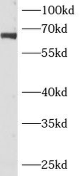 ANKRD13C Antibody