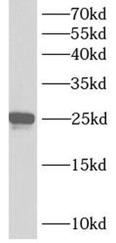 ANKRD39 Rabbit Polyclonal Antibody